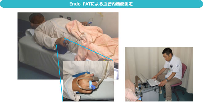 Endo-PATによる血管内機能測定
