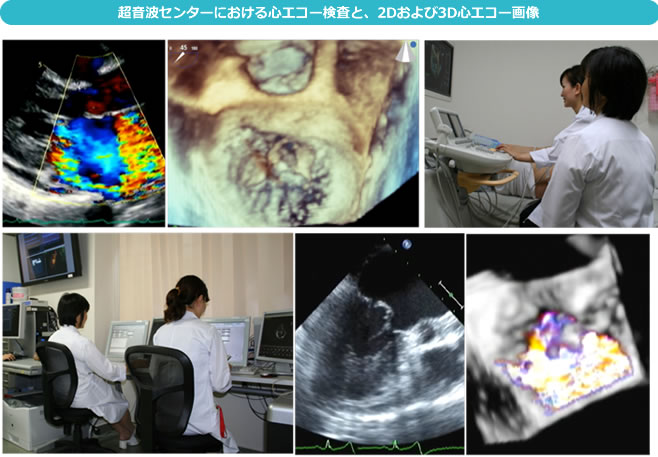 超音波センターにおける心エコー検査と、2Dおよび3D心エコー画像