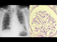 Internal Medicine II