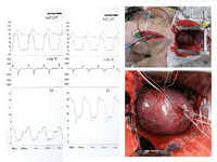 Anesthesiology