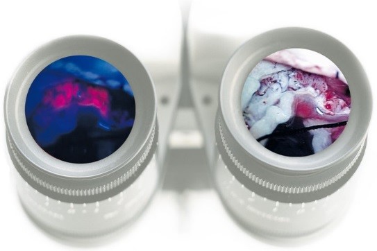 Neurosurgery