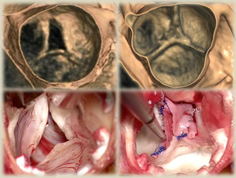 Cardiovascular Surgery