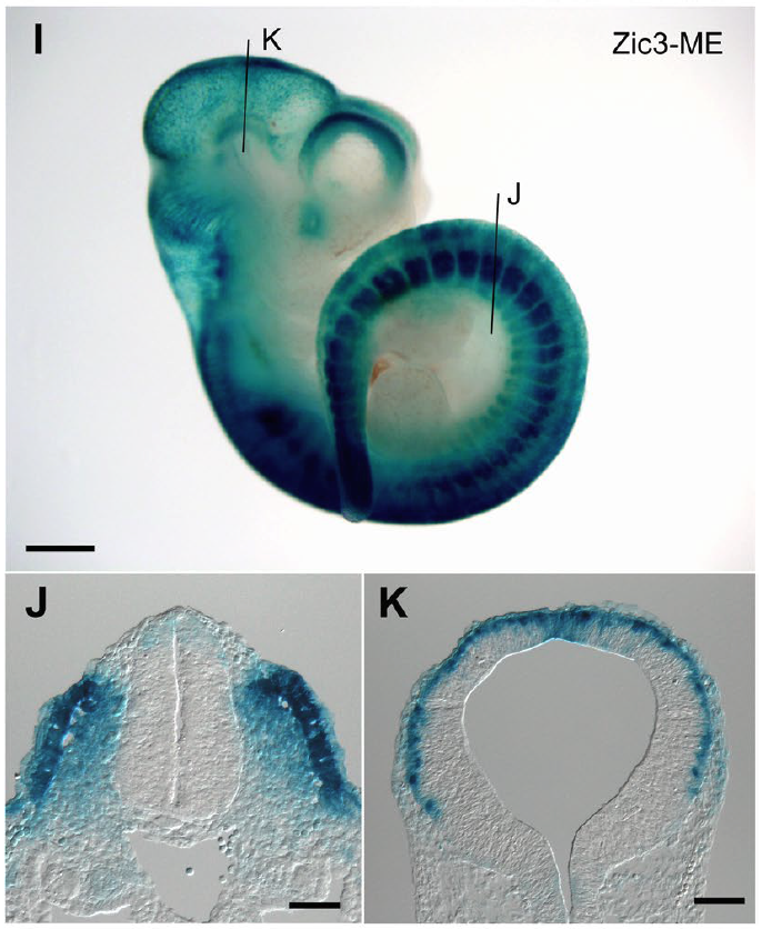 マウスの胚で行ったレポーター実験。青色の部分でZic3中胚葉エンハンサーが働いている。体節（J）と脳の表面に近いところ（K）にシグナルが見られる。