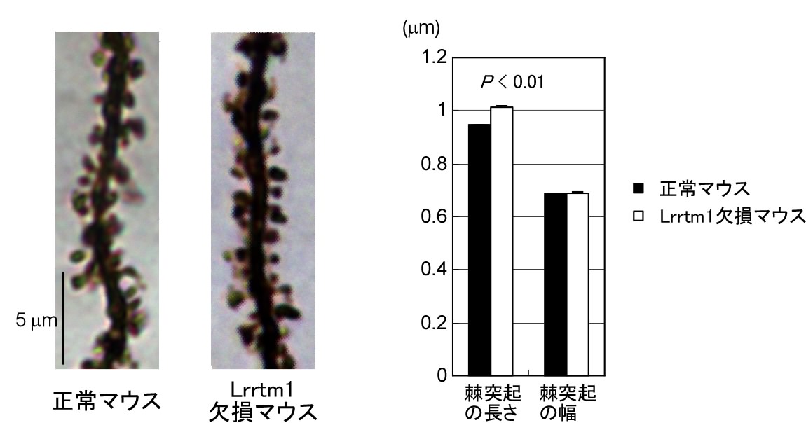 Lrrtm1欠損マウスの棘突起形成異常