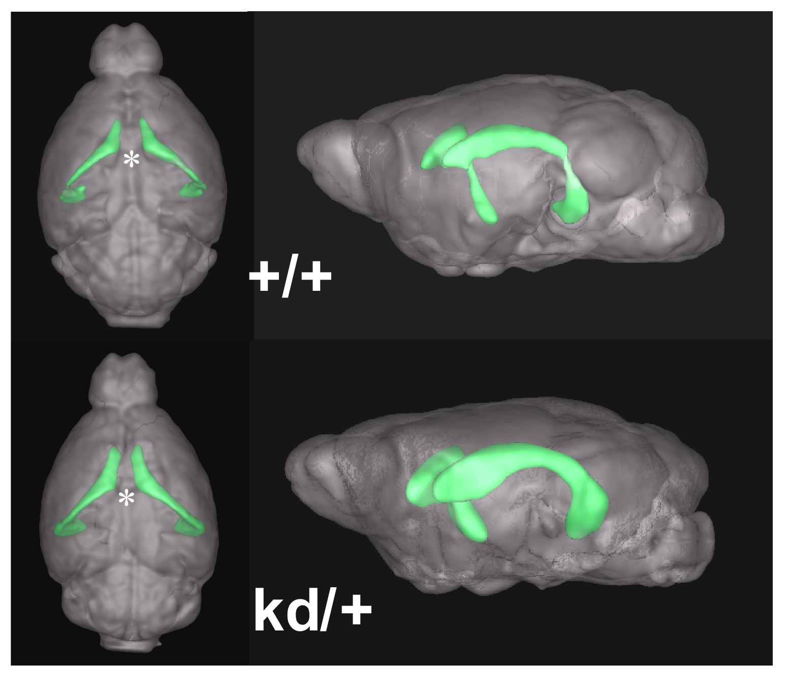 Zic2低発現変異マウス脳のMRI画像
