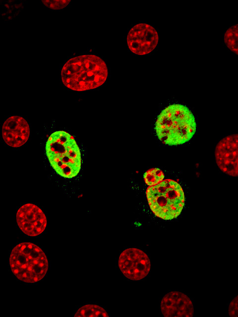 normal ZIC3 is located in cell nucleus