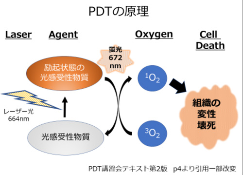 PDT（光線力学的療法）①