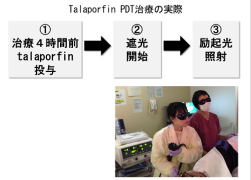 PDT（光線力学的療法）②