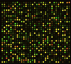 microarrayによる網羅的発現解析