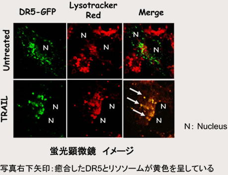 TRAIL刺激後のDR5 (緑）とリソソーム(赤）の癒合TRAIL刺激後のDR5 (緑）とリソソーム(赤）の癒合