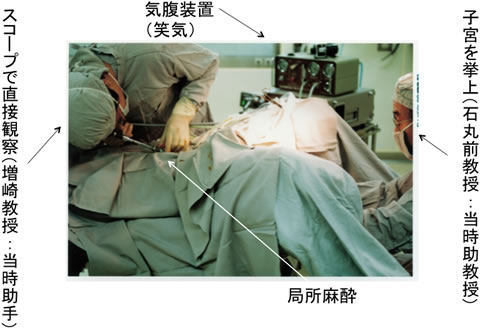 写真１：長崎大学初期の腹腔鏡（１９８２年）