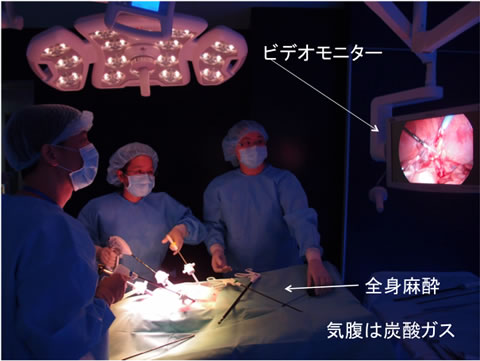 写真２：現在の腹腔鏡手術