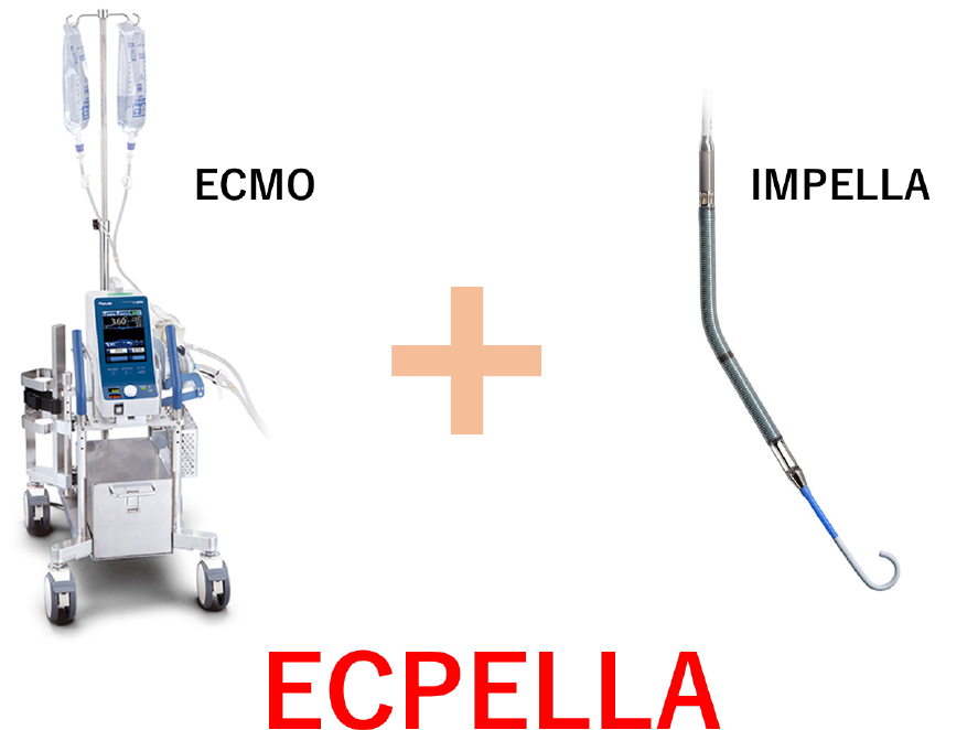 ECPELLA