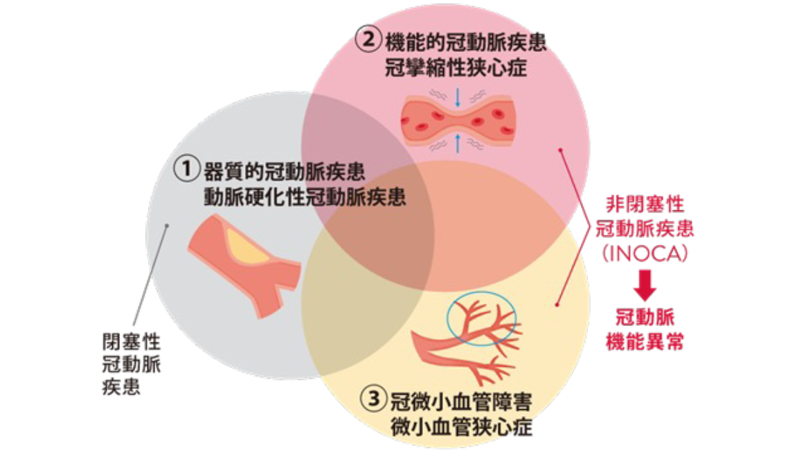 当院におけるIMPELLA疾患内訳