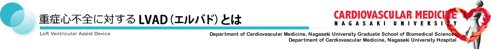 重症心不全に対するLVAD（エルバド）とは