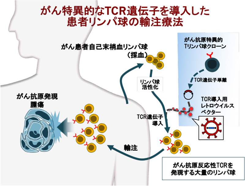 がん特異的なTCR遺伝子を導入した患者リンパ球の輸注療法