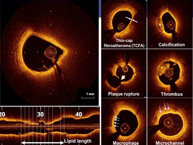 Cardiovascular Medicine