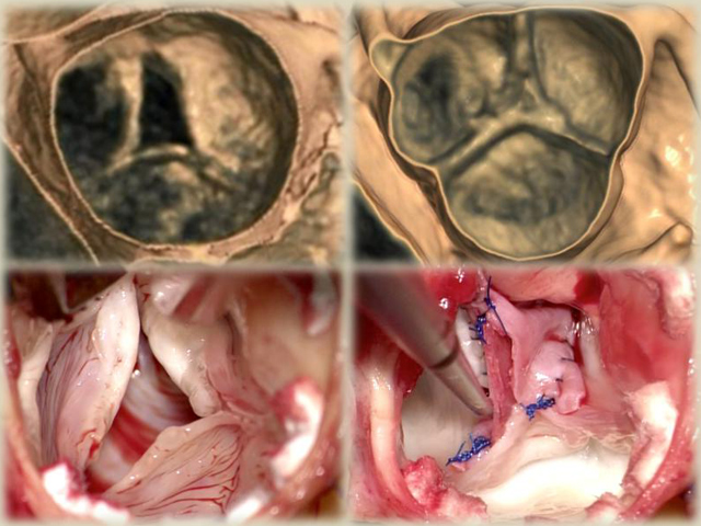 Cardiovascular Surgery