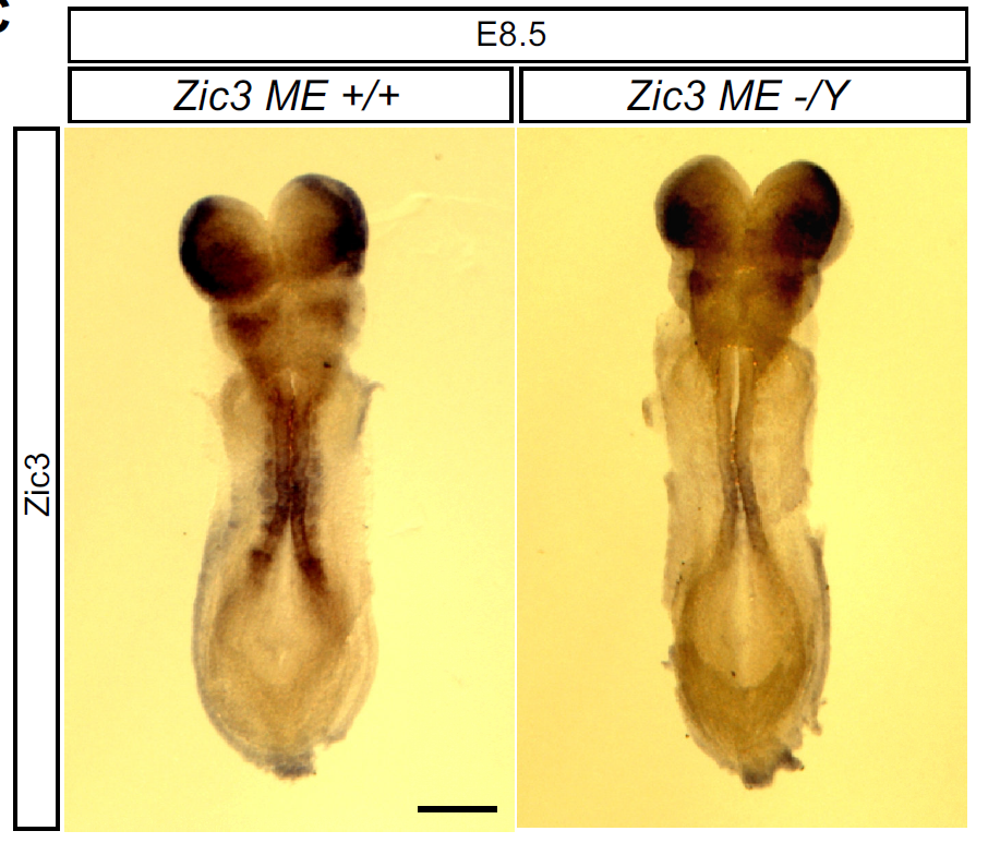 Zic3中胚葉エンハンサーの無いマウス胚（右）ではZic3の体節における発現が消えている。