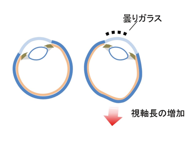 図2 片目の一部分の光情報を遮断する実験