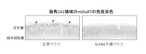 ELFN1欠損マウスにみられたmGluR7の分布異常