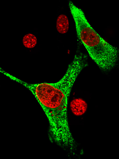 nuclear localizaition signal-lacking ZIC3 locates in cytoplasmic region