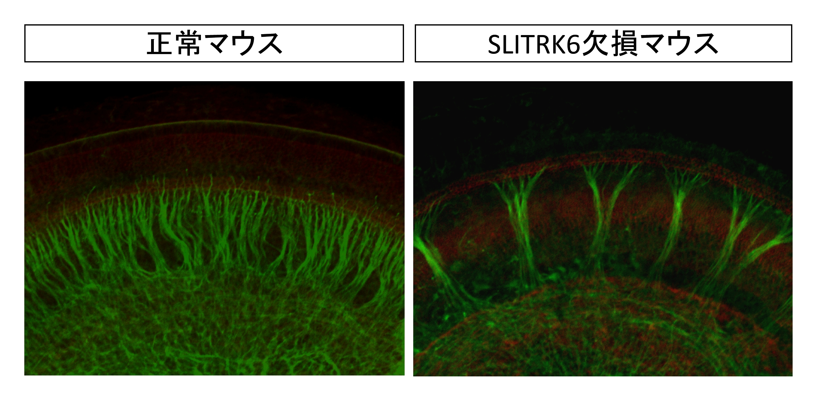 ラセン神経節から感覚上皮へ伸びる神経線維の数が減少している図です