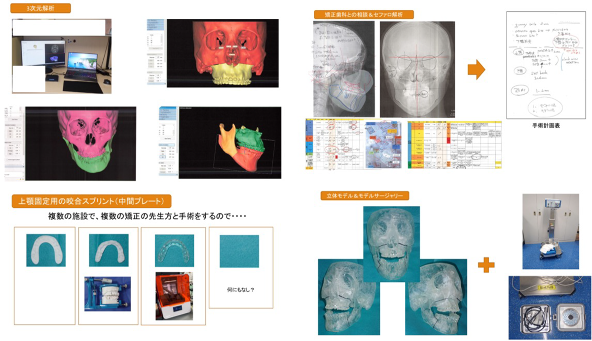 術前準備の１例